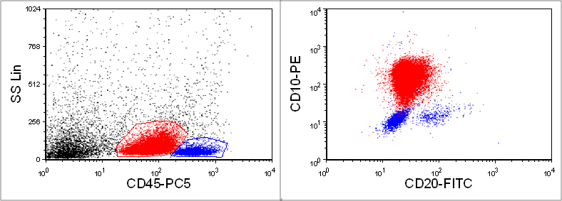 Flow cytometry at initial presentation. 